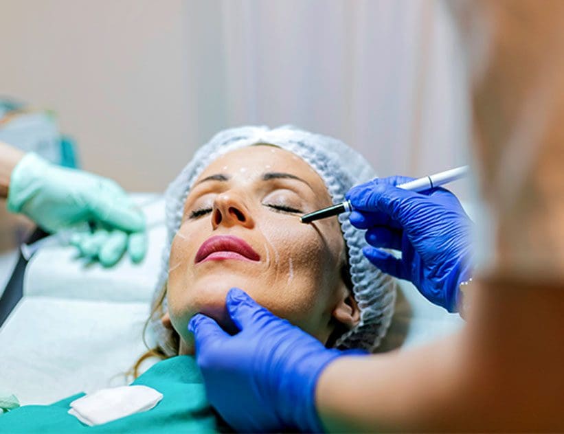 Beautician-drawing-correction-lines-on-a-female-patients-face-before-facelift