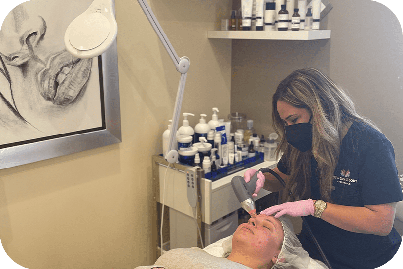 New Skin - microneedling